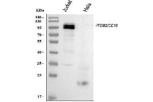 Western blot analysis of CD18/ITGB2 using anti-CD18/ITGB2 antibody (ABIN3043260). (Integrin beta 2 anticorps  (AA 404-769))