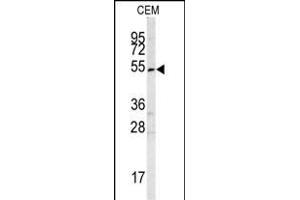 Western blot analysis of SMYD3 antibody (Center) (ABIN6242627 and ABIN6578989) in CEM cell line lysates (35 μg/lane). (SMYD3 anticorps  (AA 209-236))