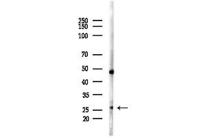 anti-N(alpha)-Acetyltransferase 11, NatA Catalytic Subunit (NAA11) (C-Term) antibody