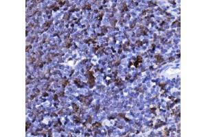 IHC analysis of CD20/MS4A1 using anti-CD20/MS4A1 antibody (ABIN7599223). (CD20 anticorps  (AA 1-291))