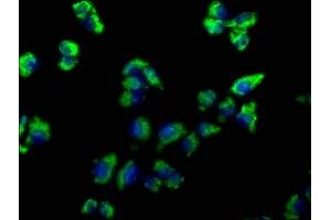 Immunofluorescence staining of Hela cells with ABIN7139819 at 1:66, counter-stained with DAPI. (EMC4 anticorps  (AA 43-60))