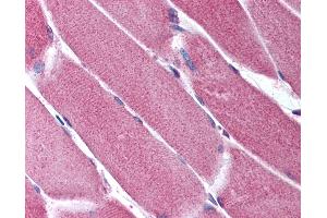 Anti-ORAI2 antibody IHC of human skeletal muscle. (ORAI2 anticorps  (C-Term))