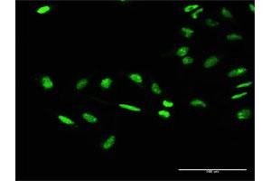 Immunofluorescence of purified MaxPab antibody to GTF2E1 on HeLa cell. (GTF2E1 anticorps  (AA 1-439))