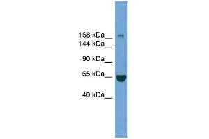 WB Suggested Anti-ZCCHC11 Antibody Titration: 0. (ZCCHC11 anticorps  (Middle Region))