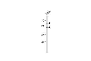 Western blot analysis of lysate from Hela cell line, using FUT8 Antibody (Center) (ABIN2802043 and ABIN2844707).