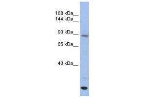 WB Suggested Anti-UNC45A Antibody Titration: 0. (UNC45A anticorps  (Middle Region))