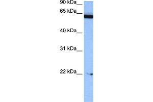 WB Suggested Anti-C14orf174 Antibody Titration: 0. (C14orf174 anticorps  (N-Term))