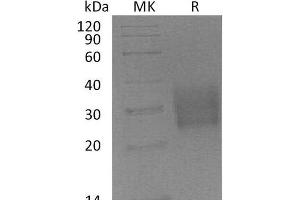 Western Blotting (WB) image for Transforming Growth Factor, beta Receptor II (70/80kDa) (TGFBR2) protein (His tag) (ABIN7320670)