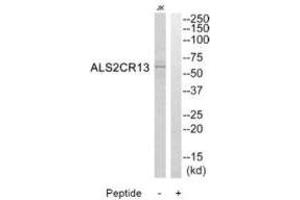 Western blot analysis of extracts from Jurkat cells, using ALS2CR13 antibody. (FAM117B anticorps  (C-Term))
