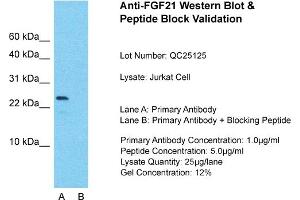 Host: Rabbit  Target Name: FGF21  Sample Tissue: Jurkat Whole Cell  Lane A:  Primary Antibody Lane B:  Primary Antibody + Blocking Peptide Primary Antibody Concentration: 1 µg/mL Peptide Concentration: 5 µg/mL Lysate Quantity: 41 µg/laneGel Concentration:.