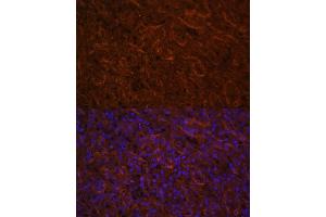 Immunofluorescence analysis of human spleen using ICOS/CD278 antibody (ABIN3022590, ABIN3022591, ABIN3022592, ABIN1513055 and ABIN6218929) at dilution of 1:100. (ICOS anticorps  (AA 21-140))