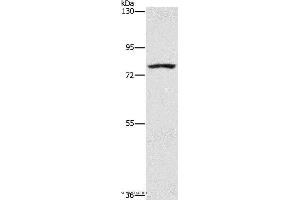 Western blot analysis of K562 cell, using SENP1 Polyclonal Antibody at dilution of 1:1500 (SENP1 anticorps)