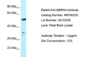 Western Blotting (WB) image for anti-WD Repeat Domain 54 (WDR54) (Middle Region) antibody (ABIN2788483) (WDR54 anticorps  (Middle Region))