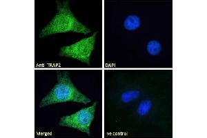 ABIN185319 Immunofluorescence analysis of paraformaldehyde fixed HeLa cells, permeabilized with 0.