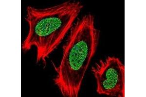 Fluorescent confocal image of HeLa cells stained with UHRF1 antibody. (UHRF1 anticorps  (AA 229-257))