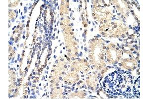 EXOSC3 antibody was used for immunohistochemistry at a concentration of 4-8 ug/ml to stain Epithelial cells of renal tubule (arrows) in Human Kidney. (EXOSC3 anticorps  (C-Term))