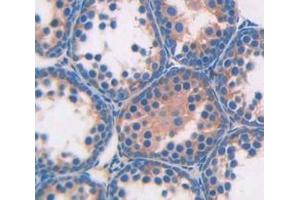 Used in DAB staining on fromalin fixed paraffin- embedded Kidney tissue (Angiotensin I Converting Enzyme 1 anticorps  (AA 334-409))