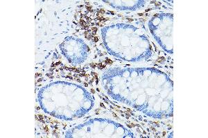 Immunohistochemistry of paraffin-embedded human colon using CD45 Rabbit pAb (ABIN3022953, ABIN3022954, ABIN3022955, ABIN1513451 and ABIN6219315) at dilution of 1:50 (40x lens).