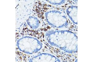 Immunohistochemistry of paraffin-embedded human colon using CD45 Rabbit pAb (ABIN3022953, ABIN3022954, ABIN3022955, ABIN1513451 and ABIN6219315) at dilution of 1:50 (40x lens). (CD45 anticorps  (AA 890-990))