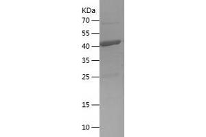 Western Blotting (WB) image for Fumarylacetoacetate Hydrolase (Fumarylacetoacetase) (FAH) (AA 97-283) protein (His-IF2DI Tag) (ABIN7123017)