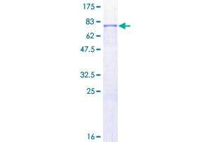 Image no. 1 for Matrix Metallopeptidase 1 (Interstitial Collagenase) (MMP1) (AA 1-469) protein (GST tag) (ABIN1311055)