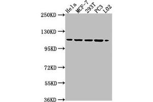 Western Blot Positive WB detected in: HeLa whole cell lysate, MCF-7 whole cell lysate, 293T whole cell lysate, PC3 whole cell lysate, L02 whole cell lysate All lanes: CSE1L antibody at 1:2000 Secondary Goat polyclonal to rabbit IgG at 1/50000 dilution Predicted band size: 111, 23, 108, 104 kDa Observed band size: 111 kDa (Exportin 2 anticorps  (AA 713-971))