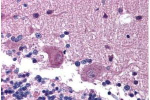 Human Brain, Cerebellum (formalin-fixed, paraffin-embedded) stained with KAL1 antibody ABIN214798 at 5 ug/ml followed by biotinylated goat anti-rabbit IgG secondary antibody ABIN481713, alkaline phosphatase-streptavidin and chromogen. (Anosmin anticorps  (AA 438-454))