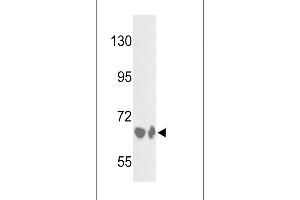Western blot analysis of BF Antibody (Center) (ABIN391536 and ABIN2841487) in HepG2 cell line and mouse liver tissue lysates (35 μg/lane). (Complement Factor B anticorps  (Center))
