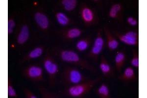 Immunofluorescence staining of methanol-fixed Hela cells using MEF2A(Phospho-Thr312) Antibody. (MEF2A anticorps  (pThr312))
