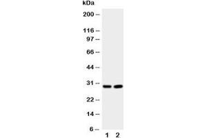 Western blot testing of Prion protein antibody and Lane 1:  rat brain;  2: rat brain. (PRNP anticorps  (Middle Region))
