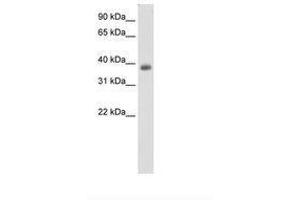 Image no. 1 for anti-Neurogenic Differentiation 2 (NEUROD2) (C-Term) antibody (ABIN6736131) (NEUROD2 anticorps  (C-Term))
