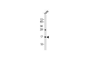 Anti p16-INK4A Antibody at 1:2000 dilution + Hela whole cell lysates Lysates/proteins at 20 μg per lane.
