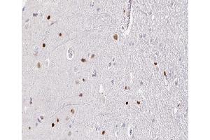 ABIN6266664 at 1/100 staining human brain tissue sections by IHC-P. (TOP2B anticorps  (N-Term))