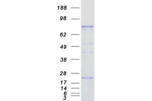 Validation with Western Blot