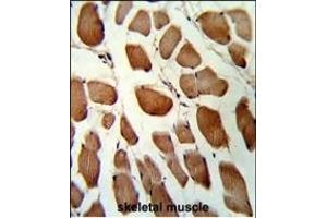 Formalin-fixed and paraffin-embedded human skeletal muscle reacted with GSTO1 Antibody (Center), which was peroxidase-conjugated to the secondary antibody, followed by DAB staining.