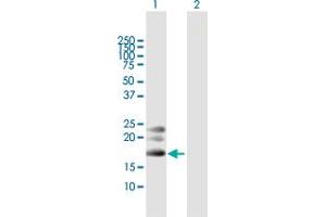 Western Blot analysis of BST2 expression in transfected 293T cell line by BST2 MaxPab polyclonal antibody.