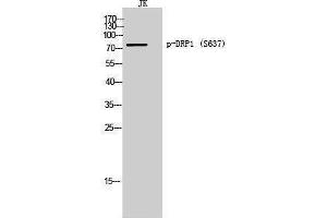 Western Blotting (WB) image for anti-Dynamin 1-Like (DNM1L) (pSer637) antibody (ABIN3182719) (Dynamin 1-Like anticorps  (pSer637))