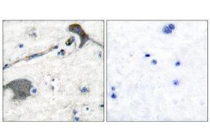 Immunohistochemistry (IHC) image for anti-RASH/RASK/RASN (N-Term) antibody (ABIN1848756) (RASH/RASK/RASN (N-Term) anticorps)