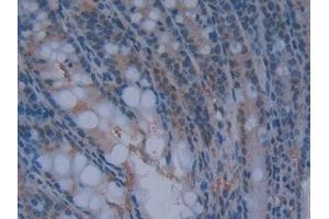 Detection of GKRP in Mouse Intestine Tissue using Polyclonal Antibody to Glucokinase Regulatory Protein (GKRP)