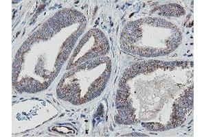 Image no. 1 for anti-Mitochondrial Ribosomal Protein S27 (MRPS27) (AA 151-414) antibody (ABIN1490969)