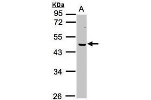 WB Image Sample (30μg whole cell lysate) A:MOLT4 , 10% SDS PAGE antibody diluted at 1:1000 (ERCC8 anticorps  (Center))