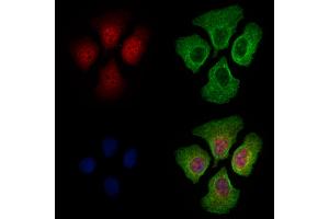 ABIN6262391 and ABIN6269042 staining Hela cells by IF/ICC.