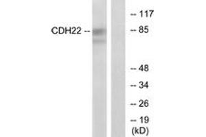 Western blot analysis of extracts from rat brain cells, using CDH22 Antibody.