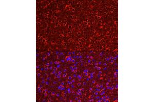 Immunofluorescence analysis of Mouse brain using P2Y12 antibody (ABIN7269752) at dilution of 1:50 (40x lens). (P2RY12 anticorps)