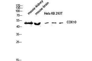 Western Blot (WB) analysis of Mouse Kidney Mouse Brain HeLa KB 293T lysis using COX10 antibody. (COX10 anticorps  (Internal Region))