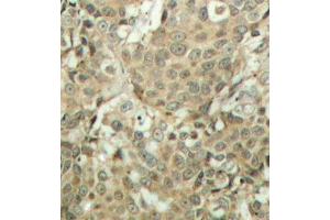 Immunohistochemistry (IHC) image for anti-Cofilin 1 (CFL1) (pSer3) antibody (ABIN3019729) (Cofilin anticorps  (pSer3))