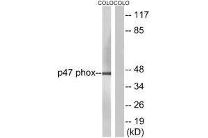 Western blot analysis of extracts from colo cells, using Neutrophil Cytosol Factor 1 (Ab-304) antibody.
