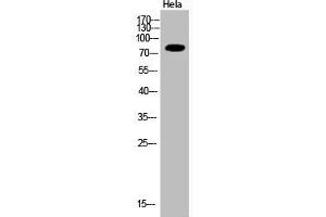 Western Blot analysis of Hela cells using Acetyl-Ub (K33) Polyclonal Antibody