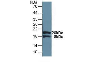 Detection of Recombinant IL1RAP, Human using Polyclonal Antibody to Interleukin 1 Receptor Accessory Protein (IL1RAP)