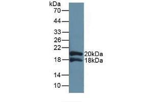 Detection of Recombinant IL1RAP, Human using Polyclonal Antibody to Interleukin 1 Receptor Accessory Protein (IL1RAP) (IL1RAP anticorps  (AA 420-558))